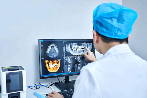 Best Emergency Wisdom Teeth Removal in Millen, GA