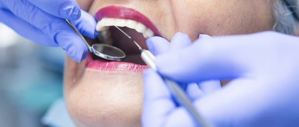 Best Emergency Broken Tooth Repair in Millen, GA